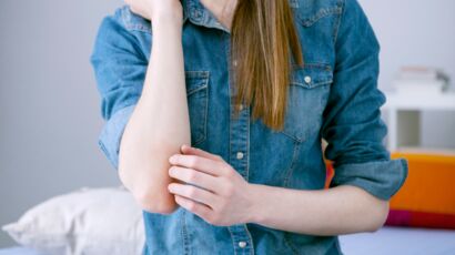 Dermatomyosite : quelle est cette maladie chronique affectant la peau et  les muscles ? : Femme Actuelle Le MAG