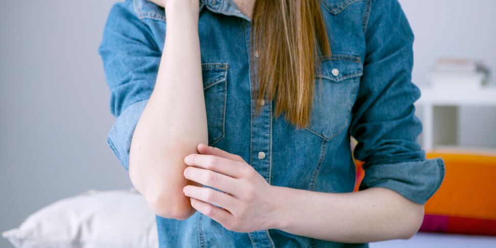 Psoriasis : comment reconnaître cette maladie inflammatoire de la peau ?