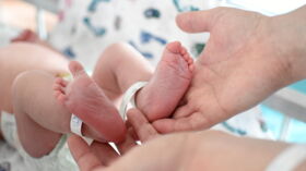 Un Bebe Nait Avec 8 Bras Et Jambes Femme Actuelle Le Mag