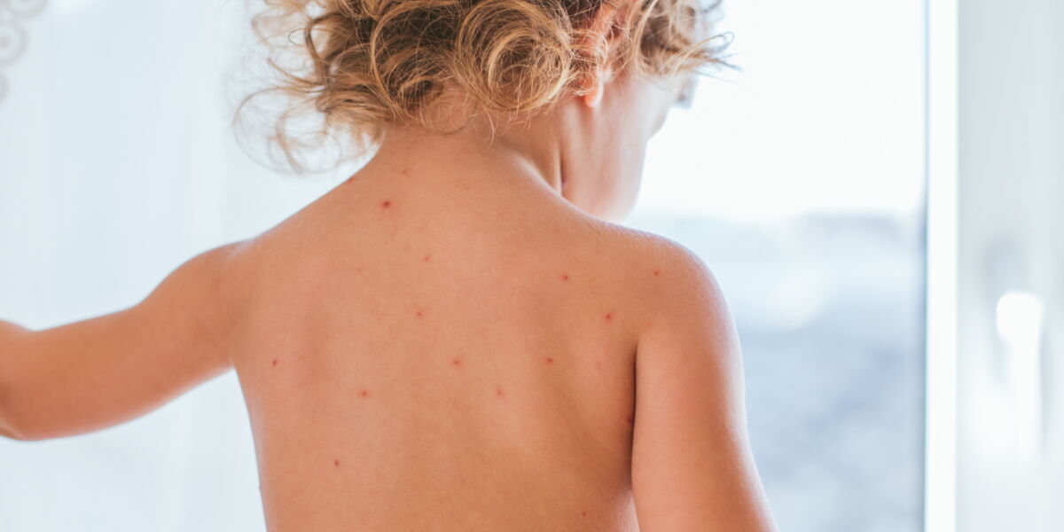 Scarlatine Symptomes Contagion Et Traitement De Cette Maladie Infectieuse De L Enfant Femme Actuelle Le Mag