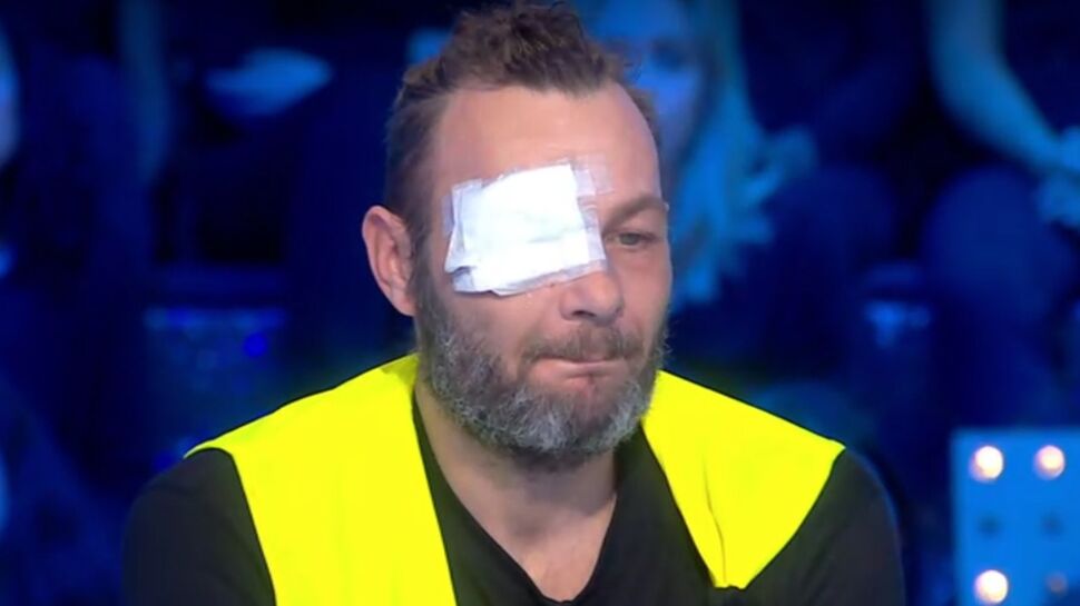 Le gilet jaune qui a perdu un oeil témoigne chez Thierry Ardisson : "J'ai tellement la haine"