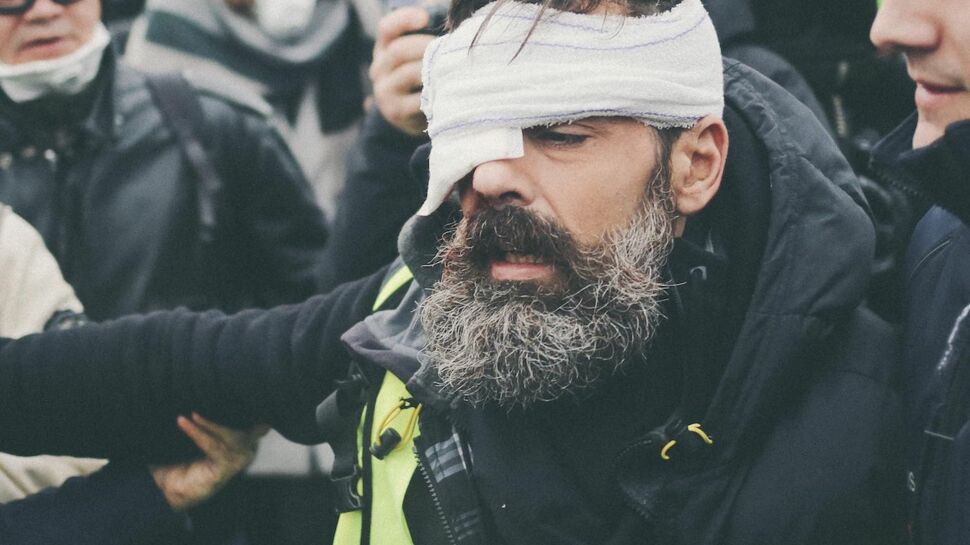 Vidéo - Le gilet jaune Jérôme Rodrigues blessé à la tête pendant qu’il filmait en direct la manifestation