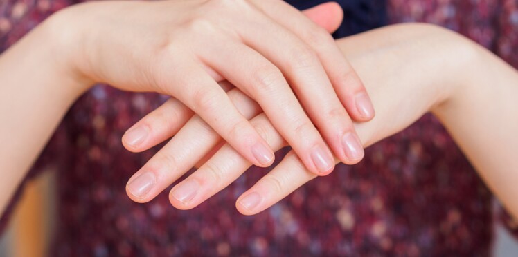 Striés Dédoublés Mous Ce Que Vos Ongles Révèlent Sur