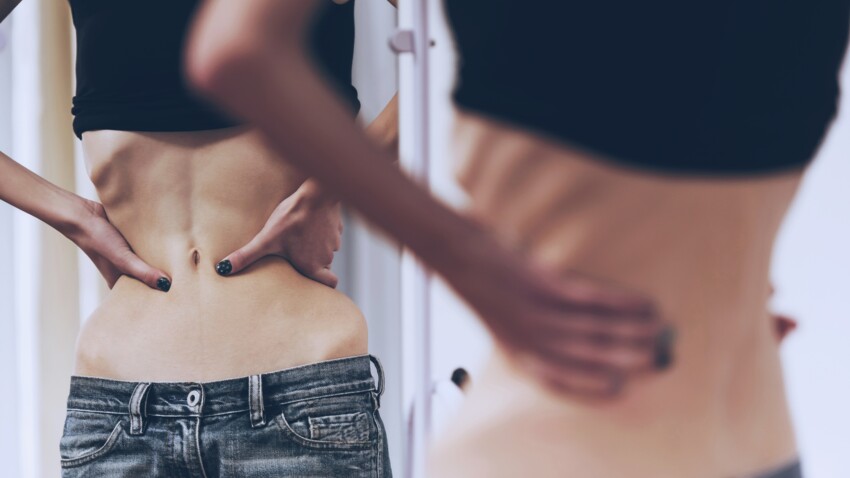 Anorexie : 5 idées reçues sur ce trouble du comportement alimentaire