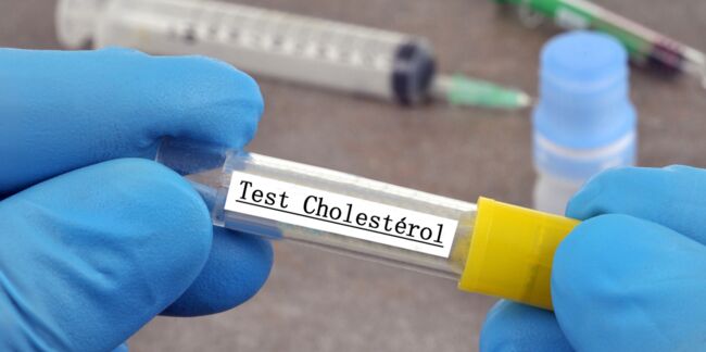 Cholestérol : quel est son rôle dans l'organisme ?