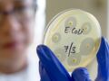 Bactérie E. Coli (Escherichia coli) : quels sont les symptômes et que risque-t-on ?
