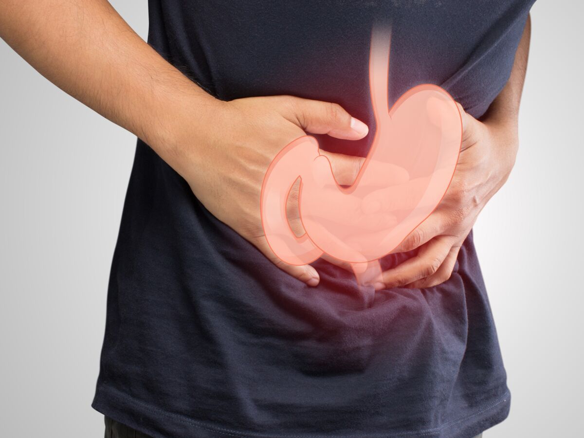 Ulcère de l'estomac (ou gastroduodénal) : causes, symptômes et ...