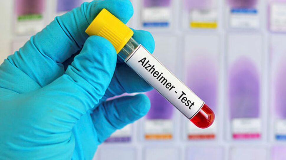 Alzheimer : un simple test sanguin pour l’évaluer