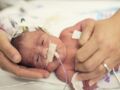 Maladie rare : un bébé naît sans peau, les médecins cherchent à le sauver