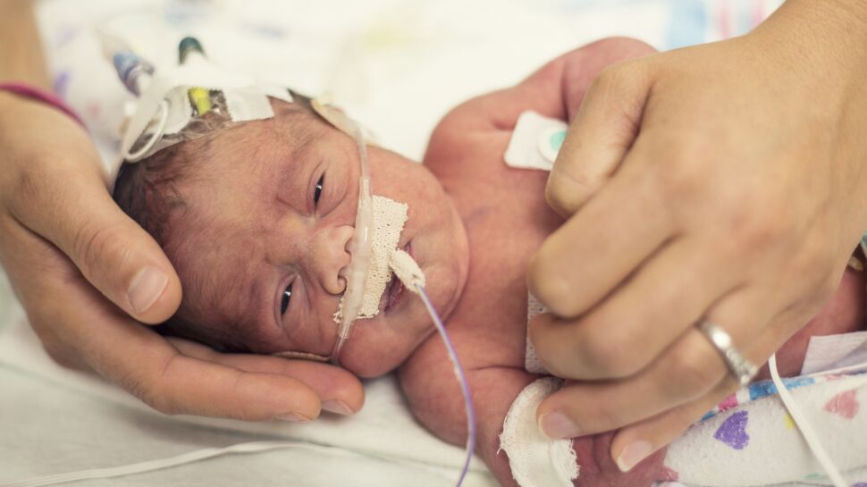 Maladie rare : un bébé naît sans peau, les médecins cherchent à le sauver
