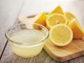 Bienfaits du citron : 25 vertus santé que vous ne soupçonnez pas