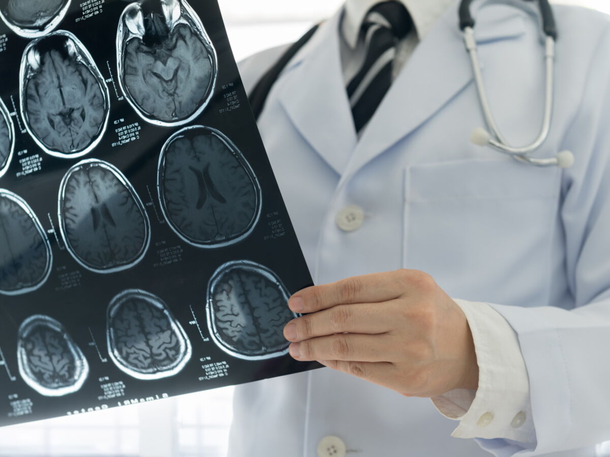 Des Medecins Croyant Operer Une Tumeur Decouvrent Un Bebe Tenia Dans Le Cerveau D Une Patiente Femme Actuelle Le Mag