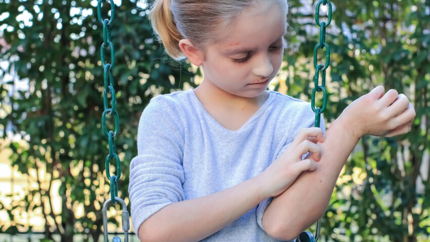 Boutons De Chaleur Piqure D Insectes Mon Enfant A Des Boutons Mais Qu Est Ce Que C Est Femme Actuelle Le Mag