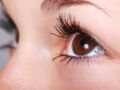 Uvéite : comment se protéger de cette grave inflammation de l'oeil ?