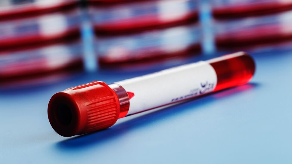 Un test sanguin capable de prédire l'échéance de la mort ?