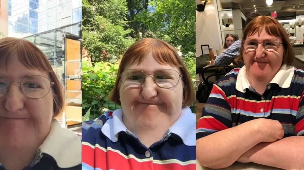 "Trop moche pour prendre des selfies", Melissa Blake une journaliste américaine atteinte de handicap répond à ses détracteurs sur Twitter