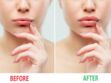 Le "lip glue challenge", le nouveau défi beauté des réseaux sociaux qui inquiète les dermatologues