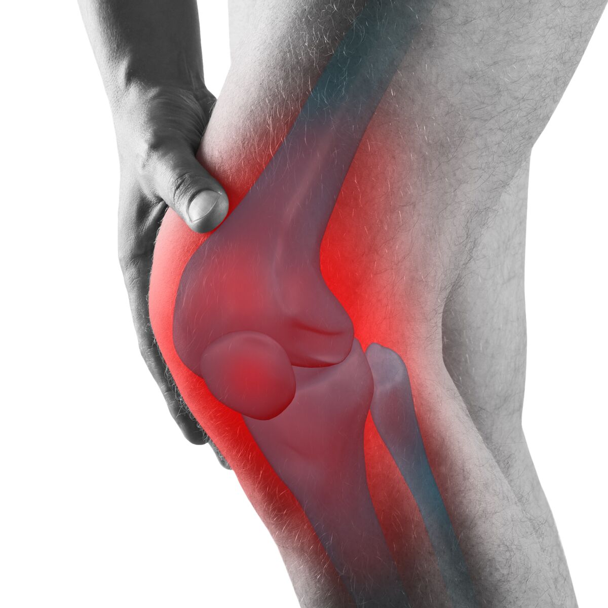 Arthrose du genou : un nouvel examen prometteur pour la