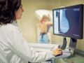 Mammographie : elle ne détecte pas seulement le cancer du sein !