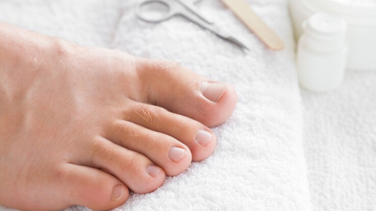 6 Astuces Incontournables Pour éviter Les Ongles Incarnés