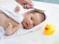 Dermatite séborrhéique du nourrisson : que faire contre les croûtes de lait de bébé ?