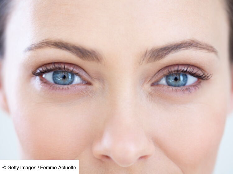 Pourquoi J Ai Les Yeux Gonfles Ce Matin Top Astuces Pour Y Remedier Femme Actuelle Le Mag