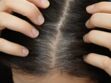 Le stress donne des cheveux blancs : des scientifiques ont enfin découvert pourquoi