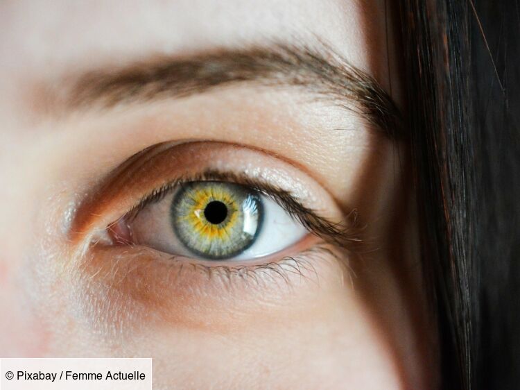 Changer la couleur de ses yeux grâce à la chirurgie : attention danger :  Femme Actuelle Le MAG