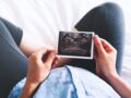 Fœtus in fœtu : quel est ce phénomène rare aussi appelé jumeau parasite ?