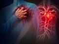 Coronavirus : des lésions cardiaques chez les malades ?