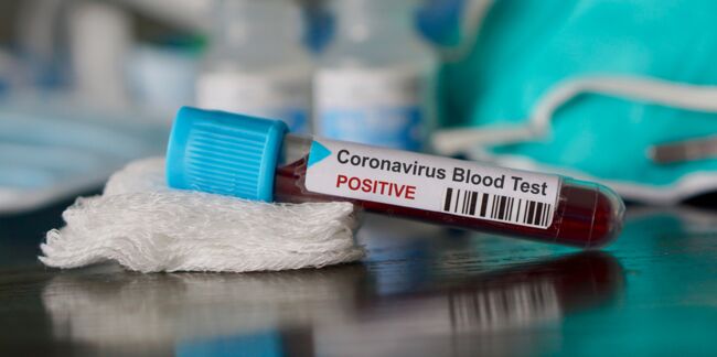 Coronavirus en France : ce que l'on sait des 25 nouveaux clusters identifiés