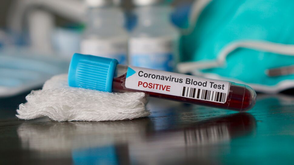 Coronavirus en France : ce que l'on sait des 25 nouveaux clusters identifiés