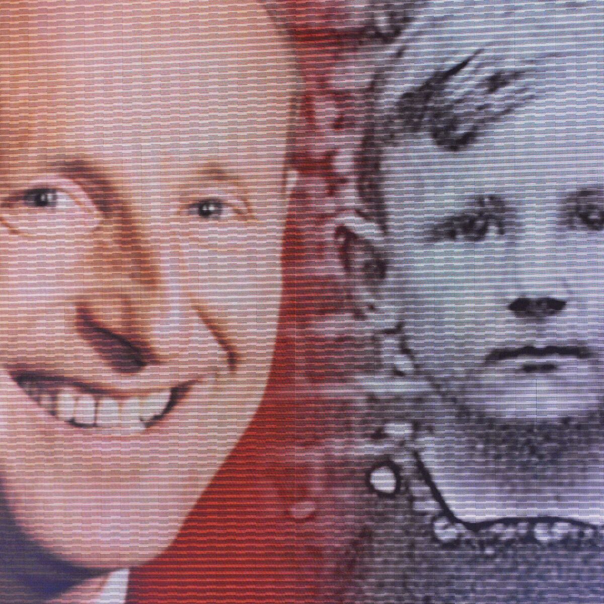 Quelle Est La Cause Du Deces De Bourvil Bourvil : ce cancer qu'il a longtemps caché : Femme Actuelle Le MAG