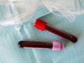 Fibrinogène : comment interpréter ses analyses sanguines ?