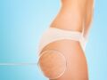 Cellulite sur les fesses : comment s'en débarrasser ?