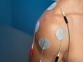 Électrocardiogramme (ECG) : comment se déroule cet examen ?