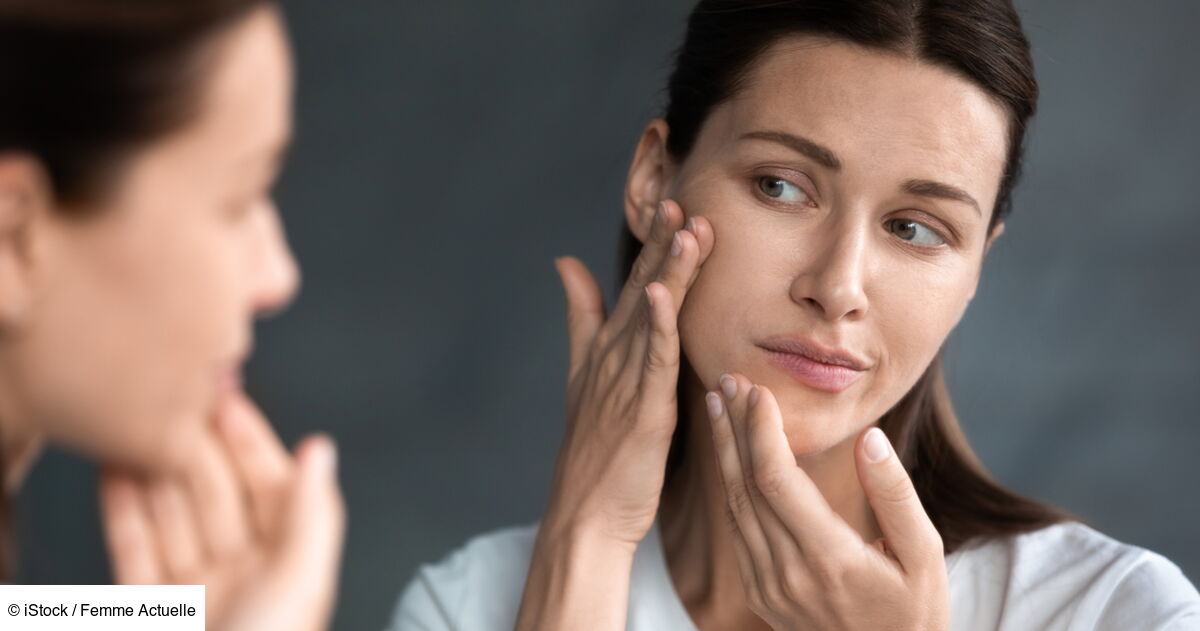 Desquamation : pourquoi a-t-on la peau qui pèle et comment y remédier