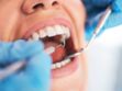 Covid-19 et parodontite : une mauvaise santé dentaire renforcerait le risque de formes graves