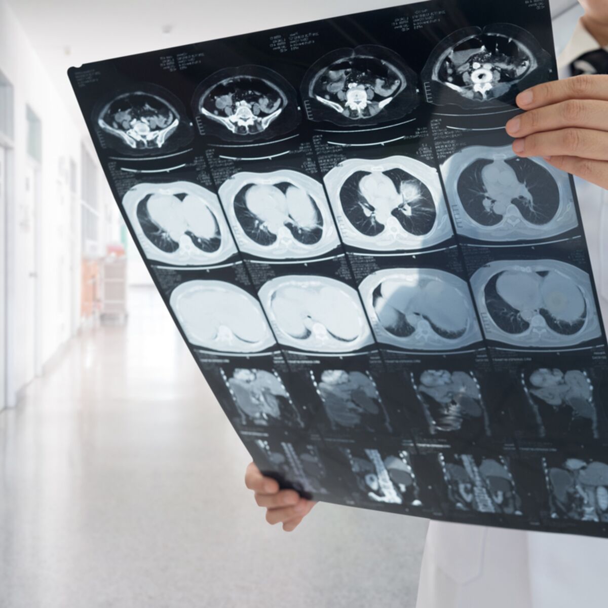 Combien De Temps Dure Un Scanner De Centrage Scanner cérébral : tout ce qu'il faut savoir sur cet examen : Femme  Actuelle Le MAG