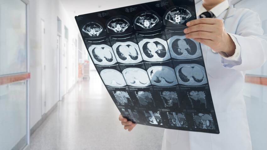 Scanner cérébral : tout ce qu’il faut savoir sur cet examen : Femme ...