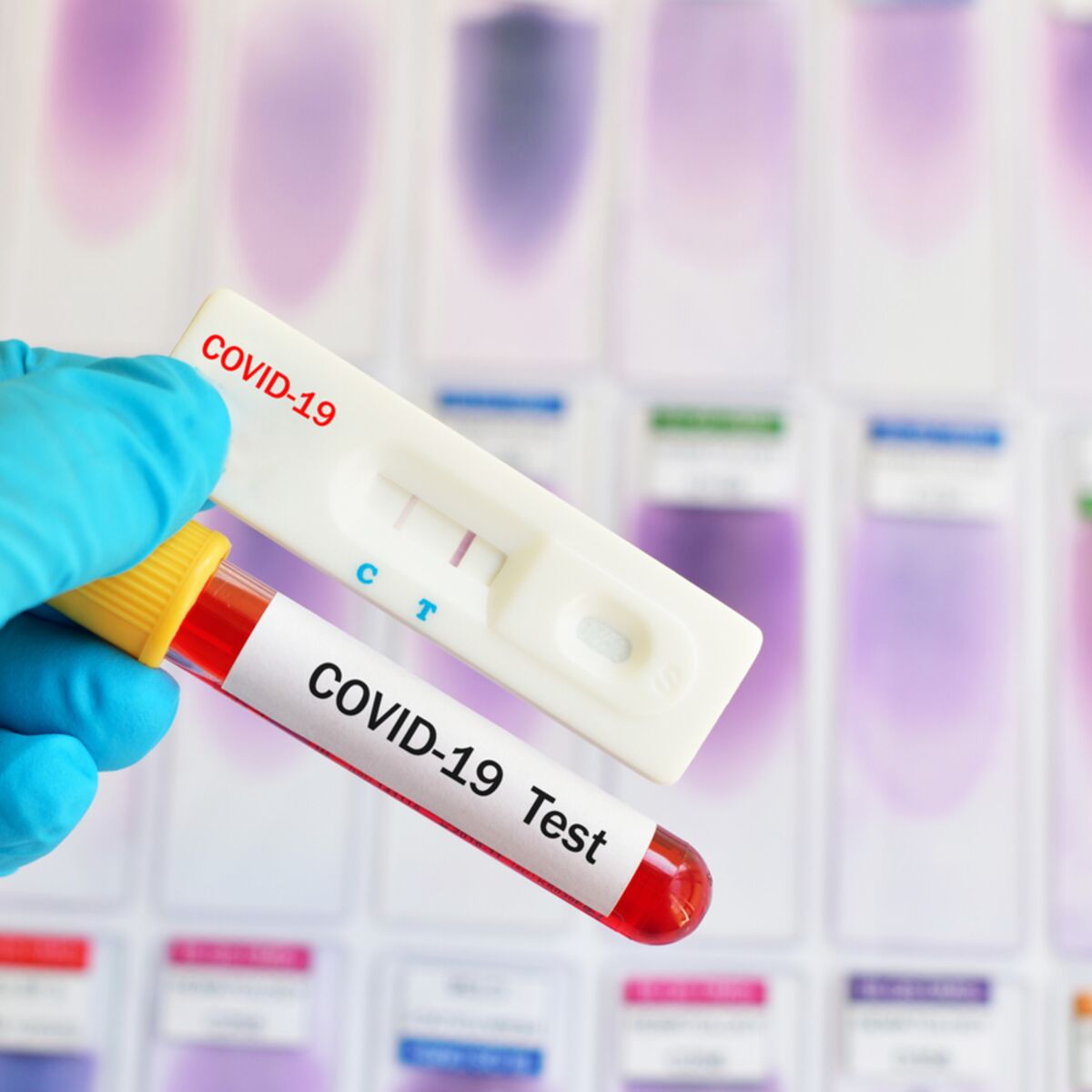 Les tests antigéniques rapides (Covid-19) : que devez-vous savoir ?