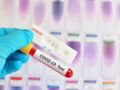 Tests antigéniques : 6 choses à savoir sur ces nouveaux dépistages ultra-rapides