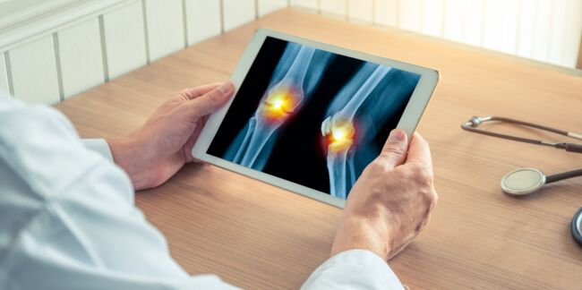 Diagnostiquer l'arthrose avant l'apparition des symptômes, bientôt possible ?