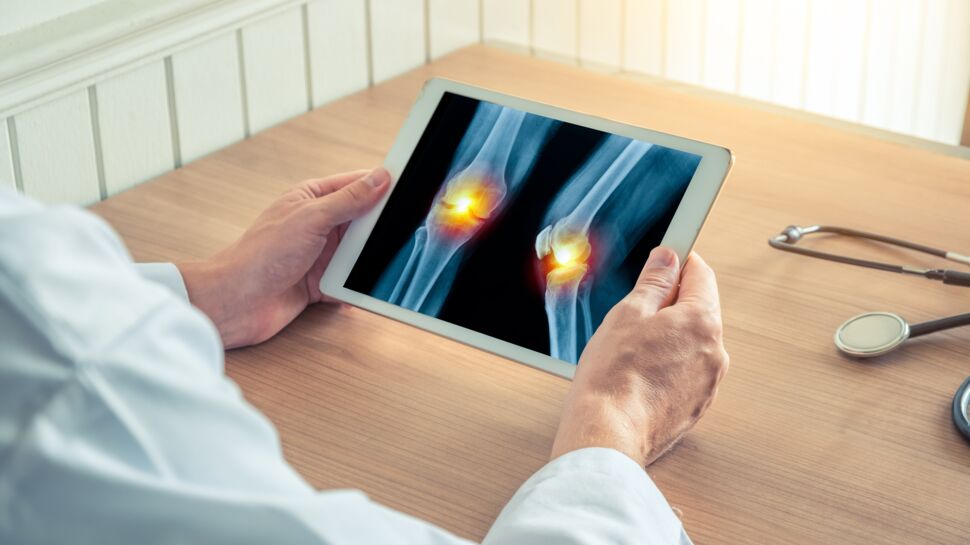 Diagnostiquer l'arthrose avant l'apparition des symptômes, bientôt possible ?
