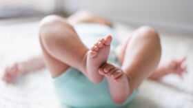 Surdosage En Vitamine D Dosage A Respecter Symptomes A Reconnaitre Risques Et Comment Reagir Femme Actuelle Le Mag Surdosage En Vitamine D Dosage A Respecter Symptomes A Reconnaitre Risques Et Comment Reagir Femme Actuelle Le Mag