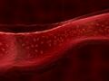Caillot de sang (thrombose) : les symptômes à reconnaître et les différents traitements