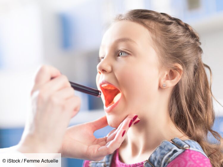 Uvulite comment soigner une luette enflée ? Femme Actuelle Le MAG