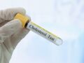 Cholestérol HDL : ce "bon" cholestérol pourrait protéger le foie d'après une étude