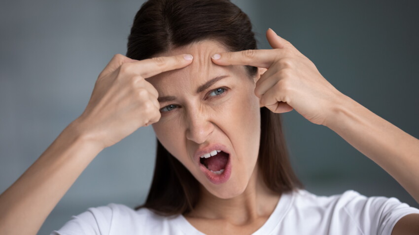 3 Astuces De Grand Mere Anti Points Noirs Femme Actuelle Le Mag