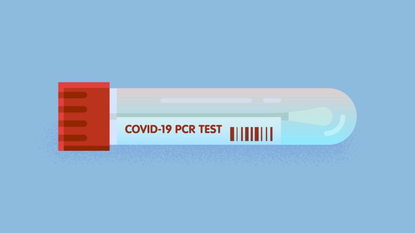 Tests Pcr Et Antigenique Combien Coutent Ils A Partir Du 15 Octobre Femme Actuelle Le Mag